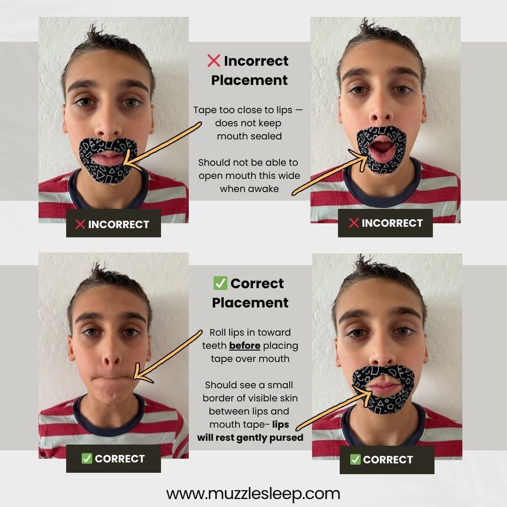 Kids Extra Sensitive Tape